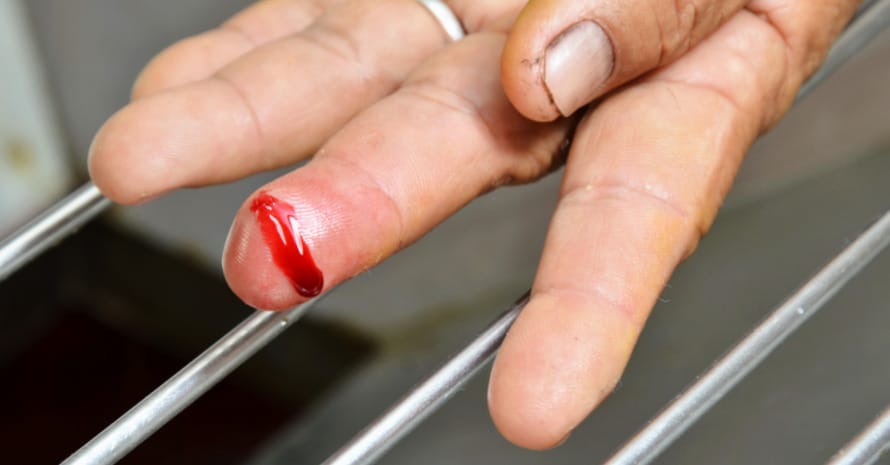 Bleeding Finger