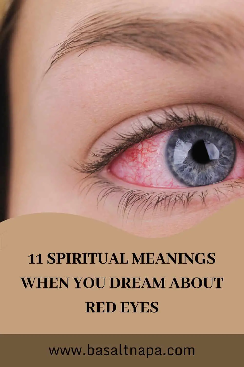 Dreams About Bleeding Eyes: Psychological Interpretations
